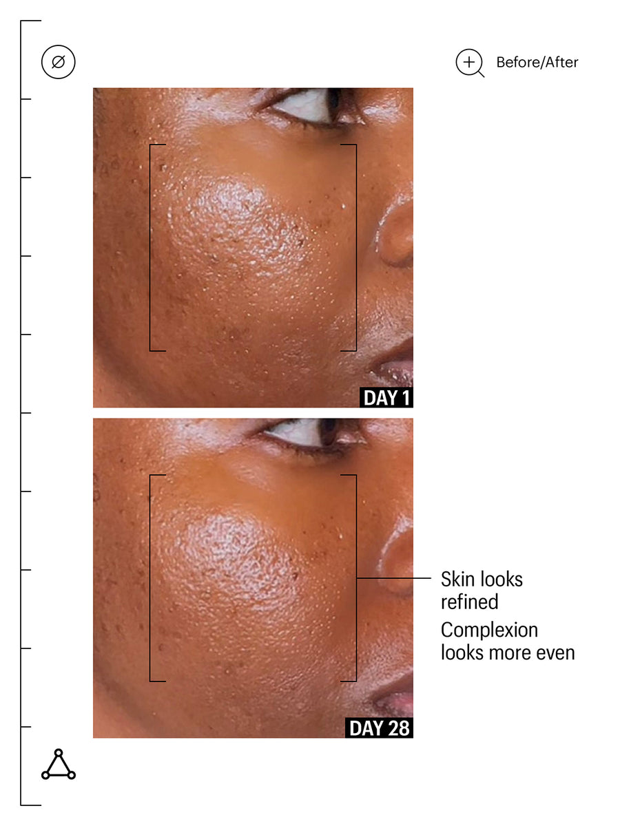 Promise Keeper Nightly Blemish Treatment