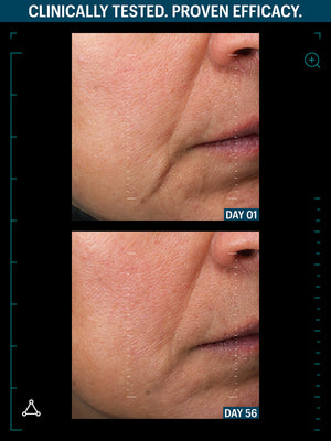 ULTIMATE LIFTING DUO – VALUE SIZE