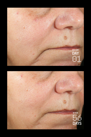 Peptides & Antioxidants Advanced Firming Daily Treatment 