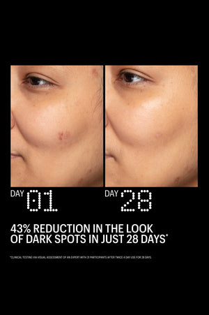 Azelaic & Kojic Advanced Clarifying Serum, Value Size