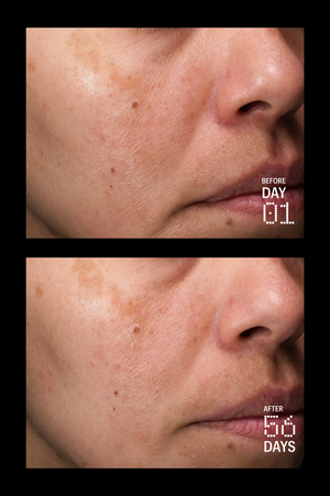 Multi Peptides & GF (Growth Factor) Advanced Lifting Serum