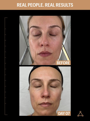 allies of skin sunscreen before after